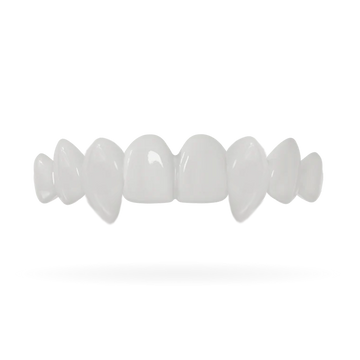 Incisors